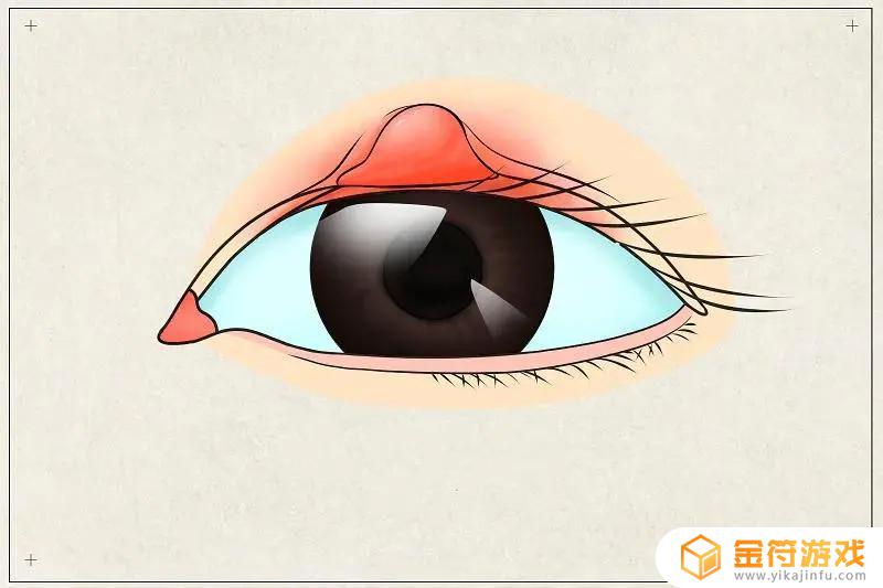 眼睛爱长麦粒肿怎么回事 眼睛反复起麦粒肿治疗方法